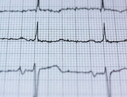La diferencia entre un infarto y un paro cardíaco