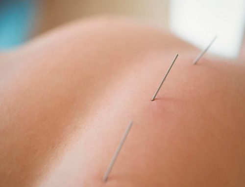 ¿Para qué nos sirve la acupuntura en la medicina?